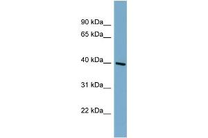 WB Suggested Anti-ST8SIA6 Antibody Titration:  0. (ST8SIA6 抗体  (Middle Region))
