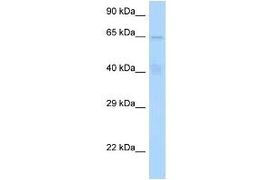 WB Suggested Anti-STAM Antibody Titration: 1. (STAM 抗体  (N-Term))