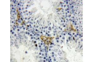 Used in DAB staining on fromalin fixed paraffin-embedded testis tissue (OGN 抗体  (AA 180-298))