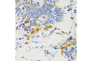 Immunohistochemistry (IHC) image for anti-Protein tyrosine Phosphatase, Non-Receptor Type 11 (PTPN11) (AA 514-593) antibody (ABIN3016707)