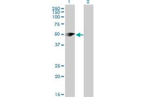 Western Blotting (WB) image for anti-Phosphatidylinositol-5-Phosphate 4-Kinase, Type II, alpha (PIP4K2A) (AA 1-406) antibody (ABIN518910)