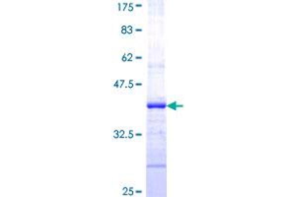 CFTR Protein (AA 1381-1480) (GST tag)