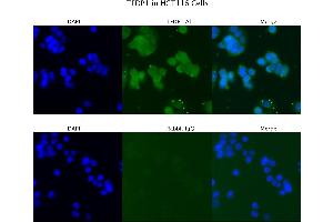 Sample Type :  HCT116   Primary Antibody Dilution:  4 ug/ml   Secondary Antibody :  Anti-rabbit Alexa 546   Secondary Antibody Dilution:  2 ug/ml   Gene Name :  TFDP1 (DP1 抗体  (N-Term))