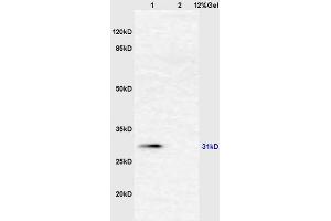 Lane 1: mouse liver lysates Lane 2: mouse intestine lysates probed with Anti AHSG/Fetuin A/Alpha 2 HS Glycoprotein Polyclonal Antibody, Unconjugated (ABIN681733) at 1:200 in 4 °C. (Fetuin A 抗体  (AA 201-300))