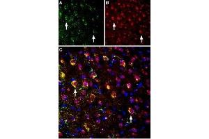 Multiplex staining of NMDAR1 and M4 muscarinic acetylcholine receptor in mouse parietal cortexImmunohistochemical staining of immersion-fixed, free floating mouse brain frozen sections using rabbit Anti-CHRM4 Antibody (ABIN7043064, ABIN7044584 and ABIN7044585), (1:400) and Guinea pig Anti-NMDAR1 (GluN1) (extracellular) Antibody (ABIN7043243, ABIN7045402 and ABIN7045403), (1:1200). (Glutamate Receptor, Ionotropic, N-Methyl D-Aspartate 1 (GRIN1) Peptide)