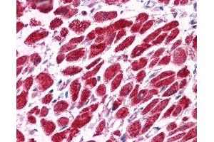 EAP30 antibody was used for immunohistochemistry at a concentration of 4-8 ug/ml. (SNF8 抗体  (N-Term))