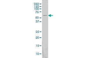 Western Blotting (WB) image for anti-Formiminotransferase Cyclodeaminase (FTCD) (AA 440-541) antibody (ABIN564712)