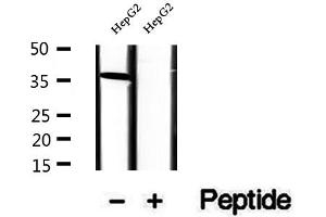 Western blot analysis of extracts of HepG2 cells, using RLBP1 antibody. (RLBP1 抗体  (Internal Region))
