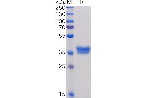 SDS-PAGE (SDS) image for Tumor Necrosis Factor Receptor Superfamily, Member 17 (TNFRSF17) (AA 1-54) protein (mFc Tag) (ABIN6961108)