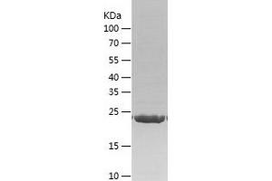 Western Blotting (WB) image for Succinate Dehydrogenase Complex, Subunit A, Flavoprotein (Fp) (SDHA) (AA 44-293) protein (His tag) (ABIN7125225) (SDHA Protein (AA 44-293) (His tag))