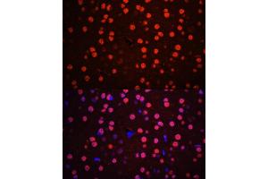 Immunofluorescence analysis of mouse brain using Phospho-p38 MAPK-T180/Y182 antibody (ABIN6135257, ABIN6136138, ABIN6136139 and ABIN6225556) at dilution of 1:100. (MAPK14 抗体  (pThr180, pTyr182))