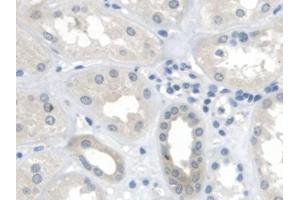Detection of MTUS1 in Human Kidney Tissue using Polyclonal Antibody to Mitochondrial Tumor Suppressor 1 (MTUS1) (MTUS1 抗体  (AA 1018-1270))