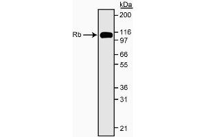 Western blot analysis of Rb. (Retinoblastoma 1 抗体  (C-Term))
