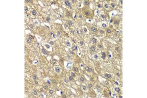 Immunohistochemistry of paraffin-embedded human liver injury using MYBPC2 antibody at dilution of 1:100 (x40 lens). (MYBPC2 抗体)
