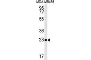 Western blot analysis in MDA-MB435 cell line lysates (35ug/lane) using MRM1 Antibody (N-term). (MRM1 抗体  (N-Term))