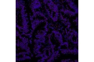 Immunofluorescent analysis of paraformaldehyde-fixed human colon cancer using Ring1A (ABIN7075467) at dilution of 1: 800 (RING1 抗体)