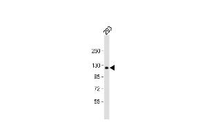 Anti-COL1A2 Antibody (N-term) at 1:1000 dilution + 293 whole cell lysate Lysates/proteins at 20 μg per lane. (COL1A2 抗体  (N-Term))