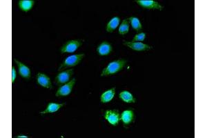Immunofluorescent analysis of A549 cells using ABIN7169222 at dilution of 1:100 and Alexa Fluor 488-congugated AffiniPure Goat Anti-Rabbit IgG(H+L) (WNK1 抗体  (AA 1-207))