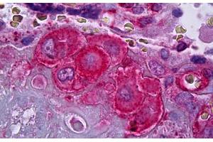 Anti-SERPINE1 / PAI-1 antibody IHC staining of human placenta, decidual cells. (PAI1 抗体)