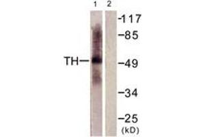 Western blot analysis of extracts from HepG2 cells, using Tryptophan Hydroxylase (Ab-58) Antibody. (Tryptophan Hydroxylase 1 抗体  (AA 26-75))