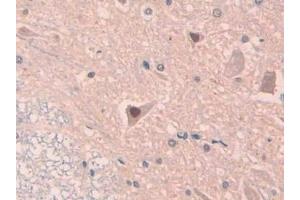 Detection of IL18 in Rat Spinal cord Tissue using Polyclonal Antibody to Interleukin 18 (IL18) (IL-18 抗体  (AA 37-194))