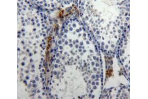 Used in DAB staining on fromalin fixed paraffin-embedded Testis tissue (IL-21 抗体  (AA 25-146))