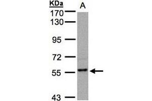 AP31129PU-N RGS14 antibody staining of MOLT4 (Lane A) whole cell lysate (30 µg) at 1/500 dilution, 7. (RGS14 抗体  (AA 504-516))