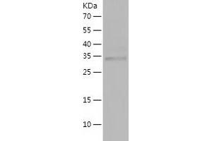 Western Blotting (WB) image for KRIT1, Ankyrin Repeat Containing (KRIT1) (AA 203-529) protein (His tag) (ABIN7123697) (KRIT1 Protein (AA 203-529) (His tag))