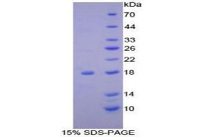 SDS-PAGE analysis of Mouse ACP Protein. (NDUFAB1 蛋白)