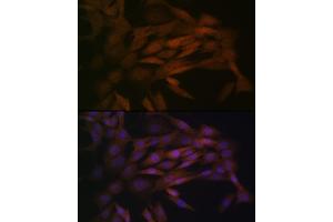 Immunofluorescence analysis of NIH-3T3 cells using MEK3 Rabbit mAb (ABIN1682965, ABIN3017630, ABIN3017631 and ABIN7101512) at dilution of 1:100 (40x lens). (MAP2K3 抗体)