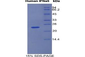 SDS-PAGE analysis of Human Interferon alpha 5 Protein. (IFNA5 蛋白)