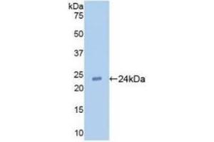 Detection of Recombinant TLR2, Human using Monoclonal Antibody to Toll Like Receptor 2 (TLR2)