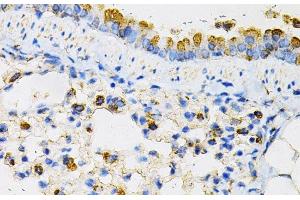 Immunohistochemistry of paraffin-embedded Mouse lung using NPC2 Polyclonal Antibody at dilution of 1:100 (40x lens). (NPC2 抗体)