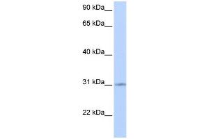 WB Suggested Anti-ZNF146 Antibody Titration:  0. (ZNF146 抗体  (Middle Region))