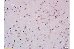 Formalin-fixed and paraffin embedded rat brain tissue labeled with Anti-PCGF1 Polyclonal Antibody, Unconjugated (ABIN713951) at 1:200 followed by conjugation to the secondary antibody and DAB staining (PCGF1 抗体  (AA 121-220))