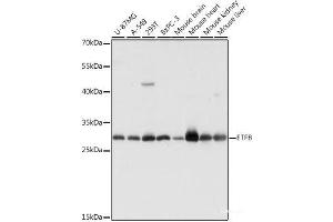 Western blot analysis of extracts of various cell lines using ETFB Polyclonal Antibody at dilution of 1:1000.