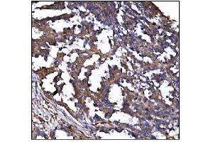 IHC analysis of POGLUT1 using anti-POGLUT1 antibody (ABIN7602910). (POGLUT1 抗体  (C-Term))