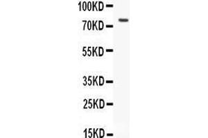Anti-hCG receptor antibody, Western blotting All lanes: Anti hCG receptor  at 0. (LHCGR 抗体  (N-Term))