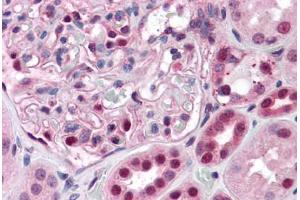 Human Kidney: Formalin-Fixed, Paraffin-Embedded (FFPE) (PAX7 抗体  (AA 411-521))