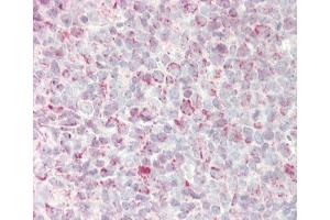 Immunohistochemistry (Paraffin-embedded Sections) (IHC (p)) image for anti-Growth Arrest and DNA-Damage-Inducible, alpha (GADD45A) (AA 1-30), (N-Term) antibody (ABIN389281)