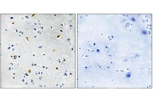 Immunohistochemistry analysis of paraffin-embedded human brain tissue using DIL-2 antibody. (TPX2 抗体  (Internal Region))