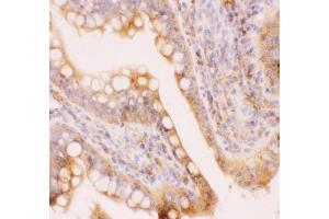 Immunohistochemistry (IHC) image for anti-ATP-Binding Cassette, Sub-Family C (CFTR/MRP), Member 4 (ABCC4) (AA 1-370) antibody (ABIN3043774)