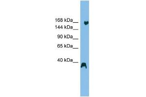 WB Suggested Anti-ZNF294 Antibody Titration: 0. (RNF160 抗体  (N-Term))