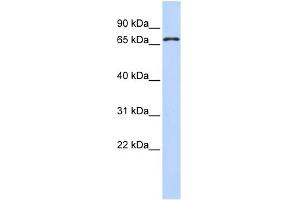 WB Suggested Anti-ZNF778 Antibody Titration:  0. (ZNF778 抗体  (N-Term))