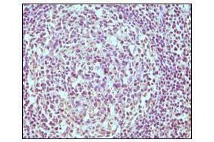 Immunohistochemical analysis of paraffin-embedded human normal lymph node, showing cytoplasmic localization using CD19 antibody with DAB staining. (CD19 抗体)