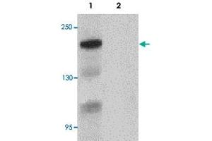 Western blot analysis of Bcl9L in HeLa cell lysate with BCL9L polyclonal antibody  at 1 ug/mL. (BCL9L 抗体  (N-Term))