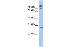 Western Blotting (WB) image for anti-Voltage-Dependent Anion Channel 3 (VDAC3) (N-Term) antibody (ABIN2776181)