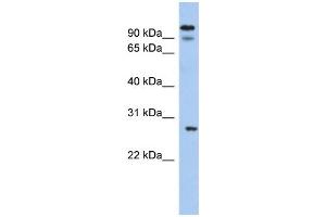 WB Suggested Anti-VDAC3 Antibody Titration:  0. (VDAC3 抗体  (N-Term))