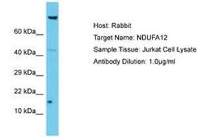 Image no. 1 for anti-NADH Dehydrogenase (Ubiquinone) 1 alpha Subcomplex, 12 (NDUFA12) (AA 6-55) antibody (ABIN6750643) (NDUFA12 抗体  (AA 6-55))