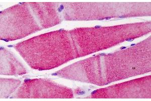 Human Skeletal Muscle: Formalin-Fixed, Paraffin-Embedded (FFPE) (ACTN3 抗体  (AA 1-50))